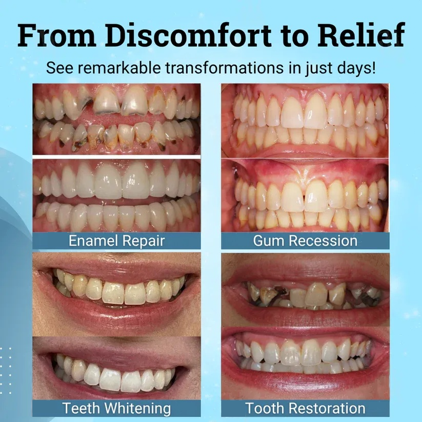 🎉 New Year's Special！👨‍⚕️ Dentist's Choice: Natravor® Non-Surgical Gum "Suture" Gel