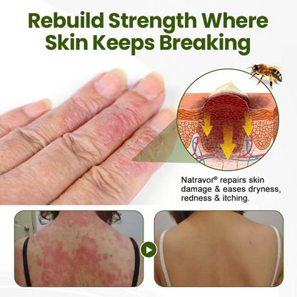 Natravor® BeePeptide RootSoft DualRelief Cream