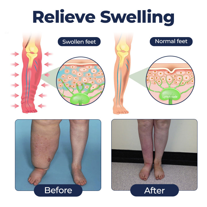 Natravor® SwellRelief Circulation Support Cream