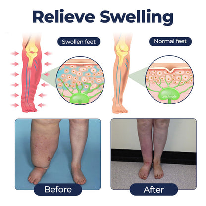 Natravor® SwellRelief Circulation Support Cream