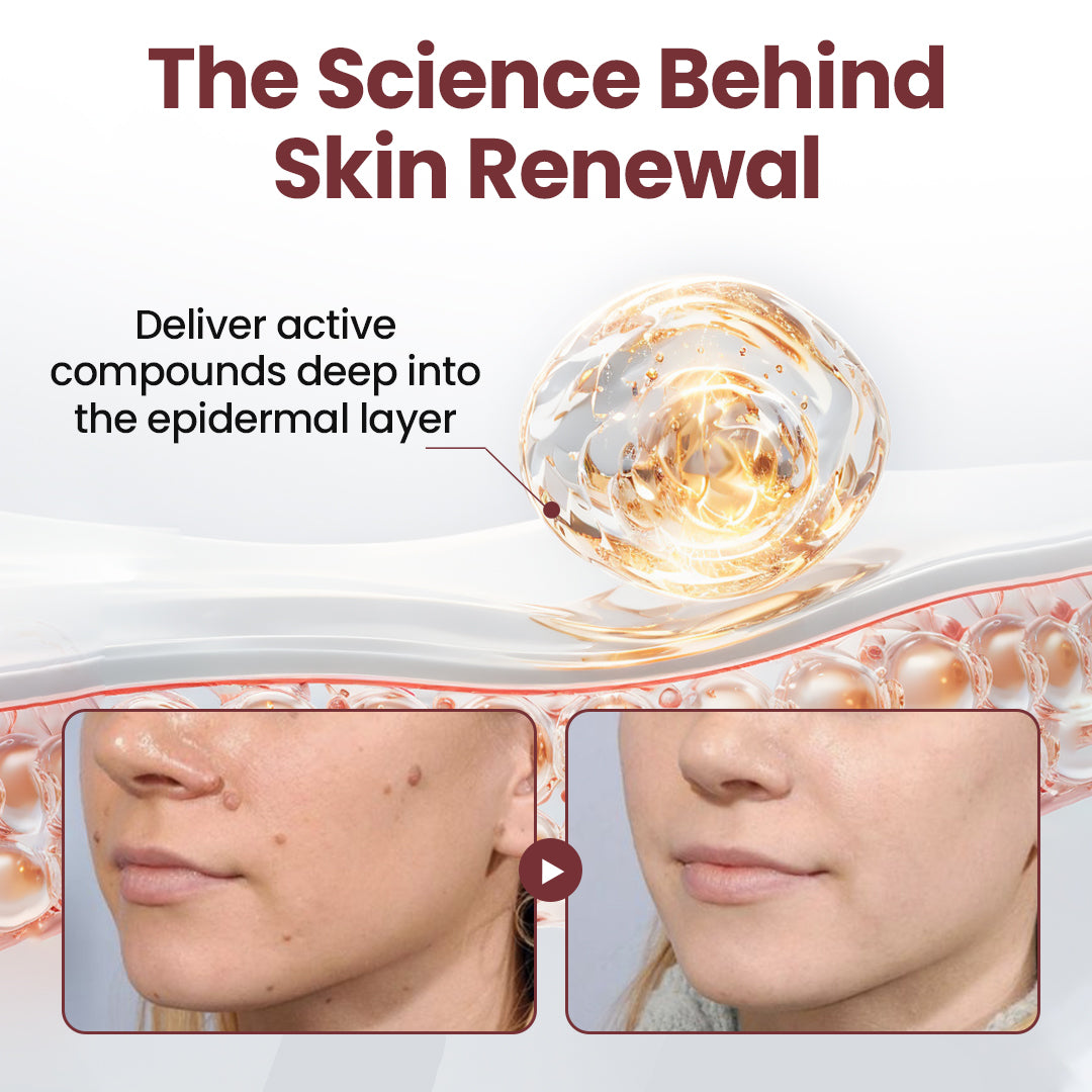 NATRAVOR® KeraErase Dual-Action Renewal Cream
