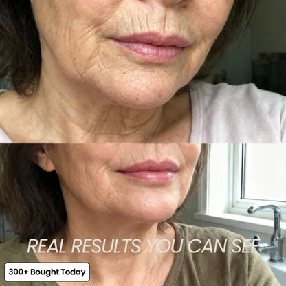 ✨LAST DAY 60% OFF  Korean Pink Collagen Volume Multi Balm
