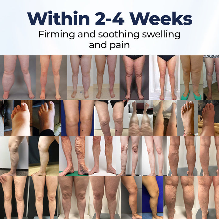 Natravor® SwellRelief Circulation Support Cream