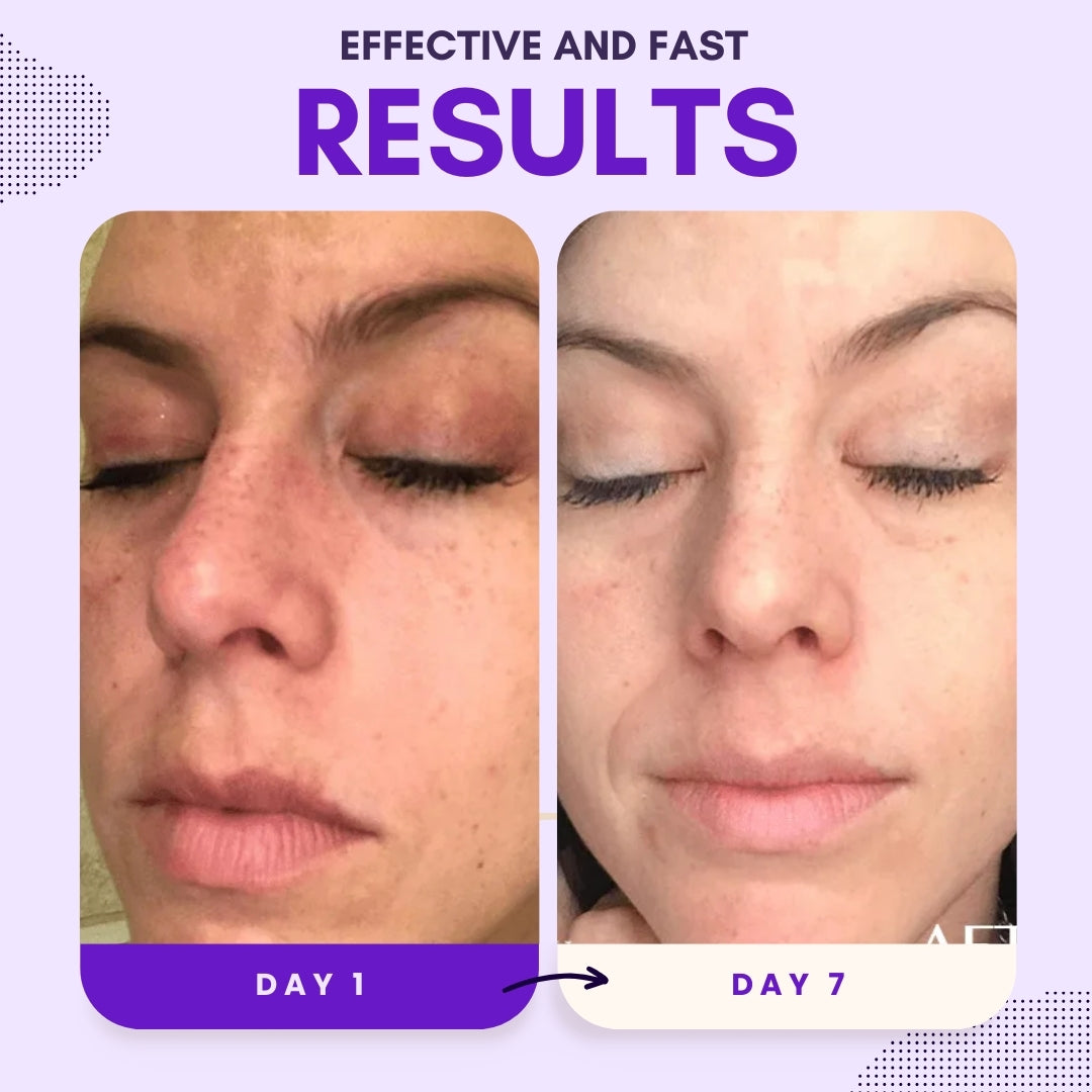 Natravor® Thiamidol 630 Serum